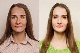 Glutathione Injections Dubai Abu Dhabi