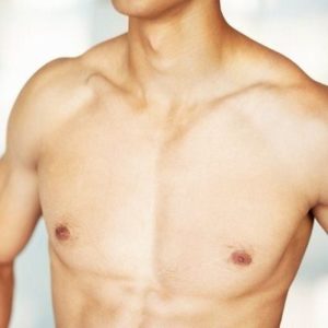 Treatment & Causes of Gynecomastia Male Breast Surgery