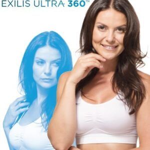 Exilis Treatment