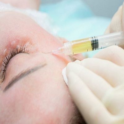 PRP Injection For Under Eyes in Dubai, Abu Dhbai & Sharjah Cost