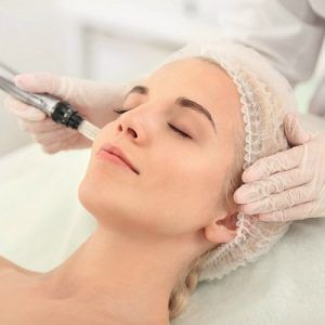 Microneedling in Dubai