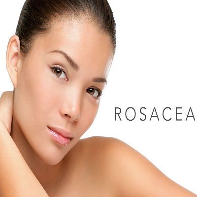 Rosacea Treatment in Dubai for Women