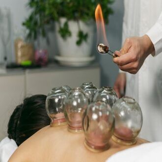 Hijama Wet Cupping Therapy In Dubai Wet Cupping Benefits