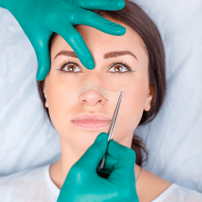Rhinoplasty in Dubai: Recovery after Your Nose Job