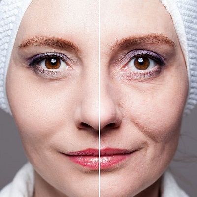 Treat Your Skin Concerns with Pico Laser Treatment in Dubai