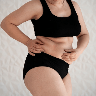 Can I lose 10 kg with Liposuction?