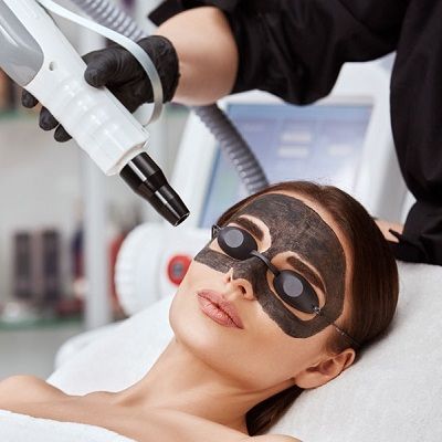 Can Laser Carbon Peel Remove Facial Hair?