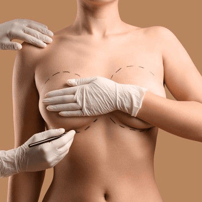 Which is Better, Breast Enlargement or Implants?