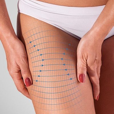 Exploring different Thigh Lift Techniques