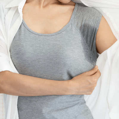 Is Morpheus8 Effective for Excessive Sweating?