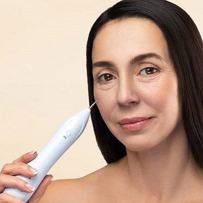 Plasma Pen for Non-Surgical Face Contouring