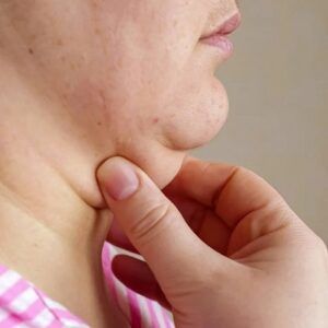 How to permanently fix Your Double Chin?