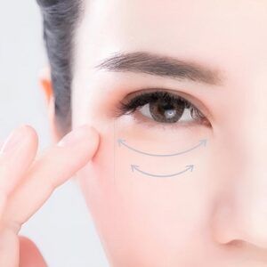 Eye Bag Removal