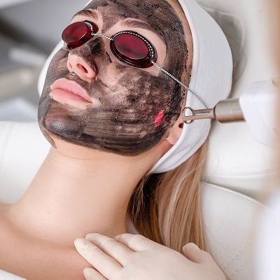 Can Laser Carbon Peels Reduce Enlarged Pores?