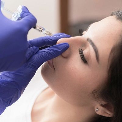 Non Surgical Rhinoplasty in Dubai