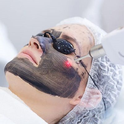 Spectra Laser Carbon Peel Dubai