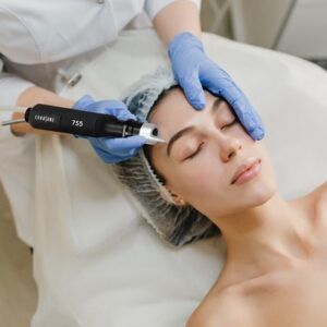 Does Pico Laser Remove Dark Spots?