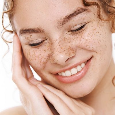 How to Get Rid of Dark Skin Freckles?